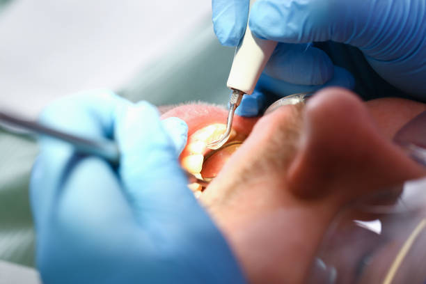 Best Broken Tooth Emergency  in Hurt, VA