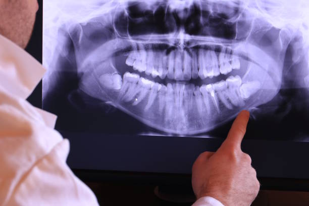 Best Knocked-Out Tooth Emergency  in Hurt, VA